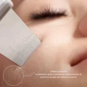 Aparelho de Peeling Esfoliante Ultrassônico Limpeza Facial Profunda Remoção de Cravos Antirrugas Sonic Skin